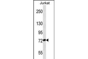 RP3 Antibody (Center) (ABIN1538291 and ABIN2849786) western blot analysis in Jurkat cell line lysates (35 μg/lane). (RPAP3 antibody  (AA 311-338))