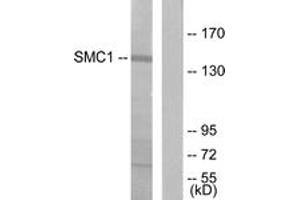 Western blot analysis of extracts from 293 cells, treated with UV 15', using SMC1 (Ab-957) Antibody. (SMC1A antibody  (AA 931-980))