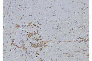 ABIN6272444 at 1/100 staining Human lung tissue by IHC-P.