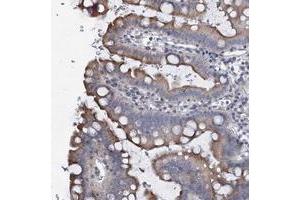 Immunohistochemical staining of human small intestine with PRHOXNB polyclonal antibody  shows moderate cytoplasmic positivity in glandular cells at 1:500-1:1000 dilution. (Ureidoimidazoline (2-Oxo-4-Hydroxy-4-Carboxy-5-) Decarboxylase (URAD) antibody)