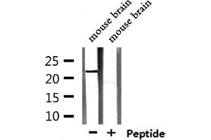 Western blot analysis of extracts from mouse brain, using TCEAL5 Antibody. (TCEAL5 antibody  (Internal Region))