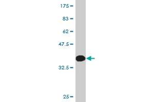 Western Blot detection against Immunogen (36. (KLF5 antibody  (AA 358-457))