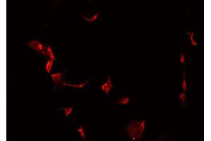 ABIN6266983 staining MCF-7 cells by IF/ICC. (MAST4 antibody  (N-Term))