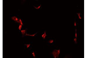 ABIN6266983 staining MCF-7 cells by IF/ICC.