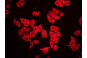 FHC cells probed with Rabbit Anti-RAC1(Ser71) Polyclonal Antibody Alexa Fluor Cy3 (RAC1 antibody  (pSer71))