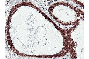 Immunohistochemical staining of paraffin-embedded Human breast tissue using anti-RNPEP mouse monoclonal antibody. (RNPEP antibody)