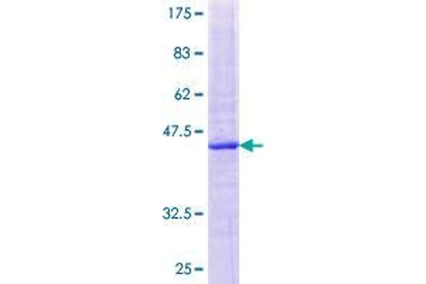 CYP2U1 Protein (AA 1-168) (GST tag)