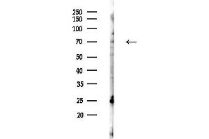 Western blot analysis of lysates from Mouse lung, using DNAI2 Antibody at 1/1000 dilution.