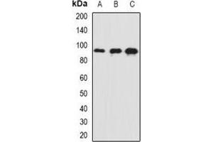 Western blot analysis of AP180 expression in mouse brain (A), mouse eye (B), rat brain (C) whole cell lysates. (SNAP91 antibody)