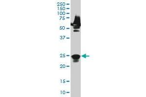 RAB33A monoclonal antibody (M04), clone 8A11. (RAB33A antibody  (AA 1-237))