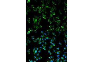 Immunofluorescence (IF) image for anti-Tropomyosin 3 (TPM3) (AA 1-284) antibody (ABIN3021721)