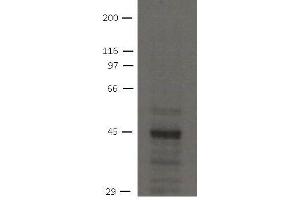 Image no. 1 for anti-Solute Carrier Family 9 (Sodium/hydrogen Exchanger), Member 3 Regulator 2 (SLC9A3R2) antibody (ABIN1169696) (SLC9A3R2 antibody)