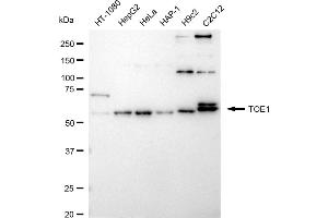 Western blotting analysis using TOE1 antibody (ABIN7800513). (Recombinant TOE1 antibody)