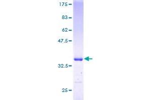 SNAPC5 Protein (AA 1-68) (GST tag)