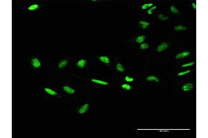 Immunofluorescence of purified MaxPab antibody to GTF2E1 on HeLa cell. (GTF2E1 antibody  (AA 1-439))