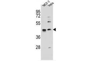 ZNF384 Antibody (C-term) western blot analysis in MCF-7, Hela cell line lysates (35 µg/lane). (ZNF384 antibody  (C-Term))