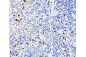 Immunohistochemistry of paraffin-embedded Mouse spleen using SMAD2 Polyclonal Antibody at dilution of 1:100 (40x lens). (SMAD2 antibody)