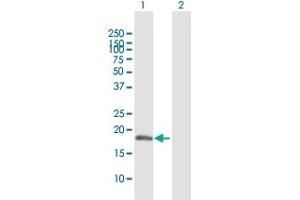 Western Blot analysis of SELS expression in transfected 293T cell line by SELS MaxPab polyclonal antibody.