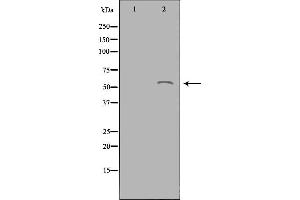 ACOT2 antibody  (Internal Region)