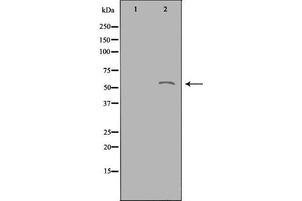 ACOT2 antibody  (Internal Region)