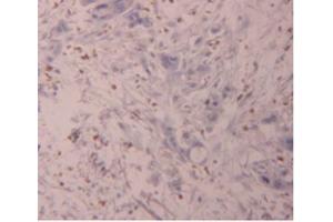 IHC-P analysis of Human Pancreas Tissue, with DAB staining. (FLG2 antibody  (AA 1222-1368))