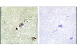 Immunohistochemistry analysis of paraffin-embedded human brain tissue, using TRIM59 Antibody. (TRIM59 antibody  (AA 191-240))