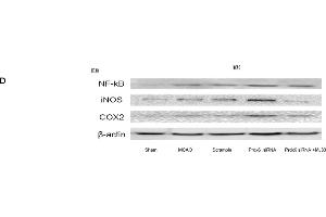 Expression of NF-κB, iNOS and COX-2 in response to Prdx6 siRNA and MJ33. (NOS2 antibody)