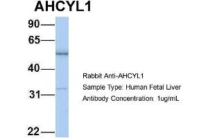 Host: Rabbit Target Name: AHCYL1 Sample Type: Human Fetal Liver Antibody Dilution: 1. (AHCYL1 antibody  (N-Term))