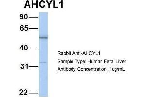 Host: Rabbit Target Name: AHCYL1 Sample Type: Human Fetal Liver Antibody Dilution: 1. (AHCYL1 antibody  (N-Term))
