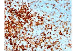 Formalin-fixed, paraffin-embedded human Tonsil stained with CD43 Mouse Recombinant Monoclonal Antibody (rSPN/1094). (Recombinant CD43 antibody)