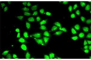 Immunofluorescence analysis of MCF-7 cells using PSMC3 Polyclonal Antibody (PSMC3 antibody)