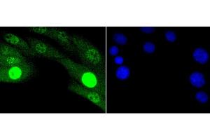 Immunofluorescence (IF) image for anti-SMAD, Mothers Against DPP Homolog 2 (SMAD2) (pThr183), (pThr221) antibody (ABIN3061343)