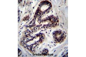 Immunohistochemistry (Paraffin-embedded Sections) (IHC (p)) image for anti-Propionyl CoA Carboxylase, alpha Polypeptide (PCCA) (AA 336-365), (Middle Region) antibody (ABIN954025)