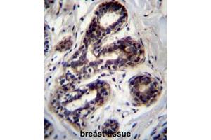 PCCA Antibody (Center) immunohistochemistry analysis in formalin fixed and paraffin embedded human breast tissue followed by peroxidase conjugation of the secondary antibody and DAB staining. (PCCA antibody  (Middle Region))