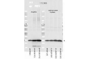 Western Blotting (WB) image for anti-Myosin, Light Chain 12A, Regulatory, Non-Sarcomeric (MYL12A) (N-Term) antibody (ABIN104491)