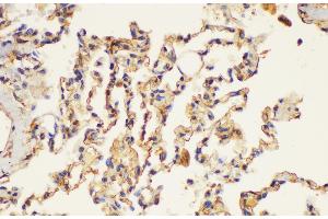 Immunohistochemistry of paraffin-embedded Human lung using PLAUR Ployclonal Antibody at dilution of 1:200. (PLAUR antibody)