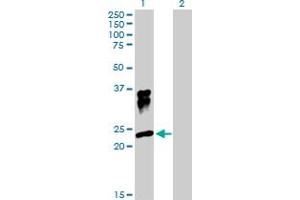 Western Blot analysis of ORM1 expression in transfected 293T cell line by ORM1 MaxPab polyclonal antibody. (ORM1 antibody  (AA 1-201))