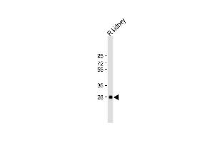 All lanes : Anti-BSND Antibody (C-term) at 1:2000 dilution Lane 1: rat kidney lysate Lysates/proteins at 20 μg per lane. (BSND antibody  (C-Term))