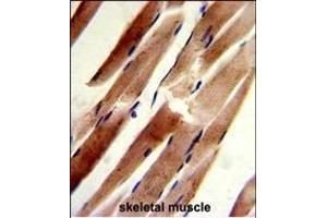 Formalin-fixed and paraffin-embedded human skeletal muscle reacted with ACTR2 Antibody (C-term), which was peroxidase-conjugated to the secondary antibody, followed by DAB staining. (ACTR2 antibody  (C-Term))