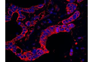 Immunofluorescence (IF) image for anti-Eukaryotic Translation Initiation Factor 4 gamma 2 (EIF4G2) (AA 125-175) antibody (ABIN7448949)