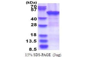 SDS-PAGE (SDS) image for Zinc Finger, CCHC Domain Containing 12 (ZCCHC12) (AA 1-402) protein (His tag) (ABIN5853735) (ZCCHC12 Protein (AA 1-402) (His tag))