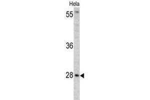 Western blot analysis of HPRT1 antibody (C-term) in Hela cell line lysates (35ug/lane).