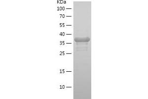 RPA2 Protein (AA 81-217) (His-IF2DI Tag)