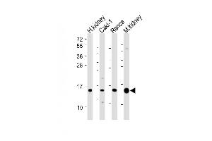 All lanes : Anti-ATP6V1G3 Antibody (N-Term) at 1:2000 dilution Lane 1: Human kidney lysate Lane 2: Caki-1 whole cell lysate Lane 3: Renca whole cell lysate Lane 4: Mouse kidney lysate Lysates/proteins at 20 μg per lane. (ATP6V1G3i antibody  (AA 15-49))