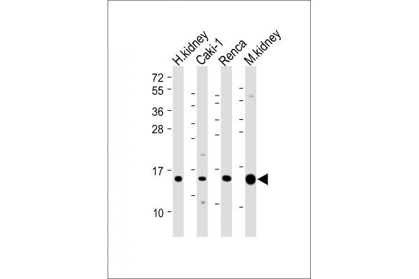 ATP6V1G3i 抗体  (AA 15-49)
