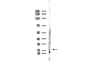 anti-Ring Finger Protein 114 (RNF114) antibody