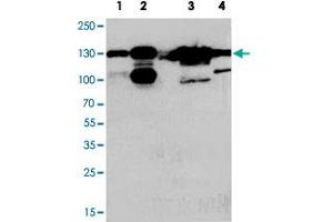 Western blot analysis of whole cell extracts with THBS2 polyclonal antibody .