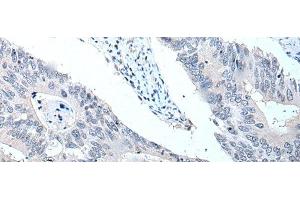 Immunohistochemistry (Paraffin-embedded Sections) (IHC (p)) image for anti-Vacuolar Protein Sorting 35 (VPS35) antibody (ABIN7248266)