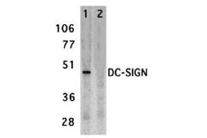 Western Blotting (WB) image for anti-CD209 (CD209) (Extracellular Domain) antibody (ABIN1030833) (DC-SIGN/CD209 antibody  (Extracellular Domain))
