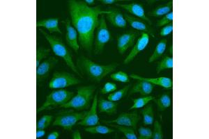 IF analysis of OAS3 using anti-OAS3 antibody (ABIN7602725). (OAS3 antibody  (AA 990-1087))